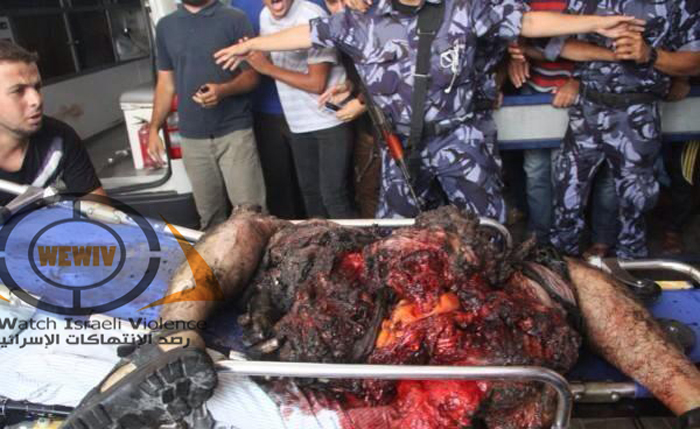 جرائم الاحتلال الاسرائيلي في غزة
