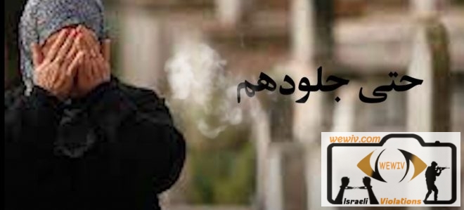 حتى جلودهم